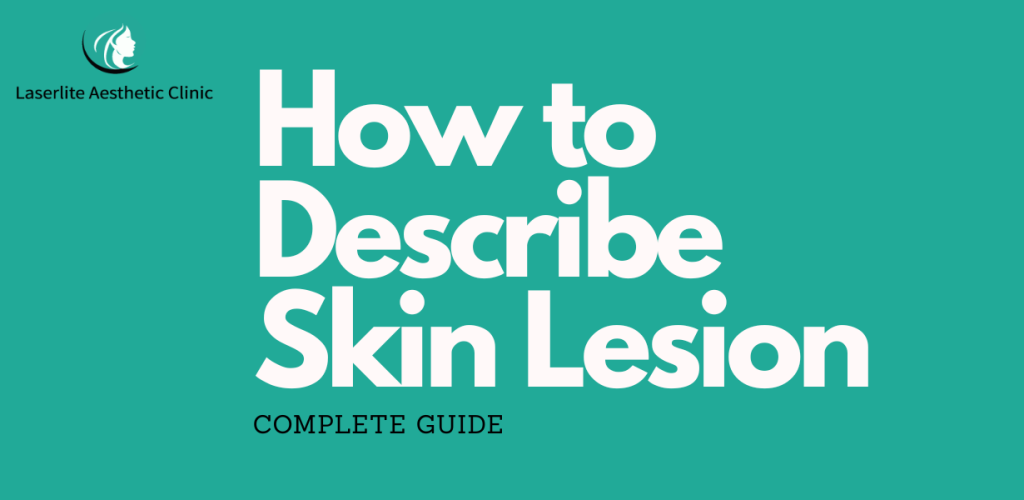 How to Describe a Skin Lesion