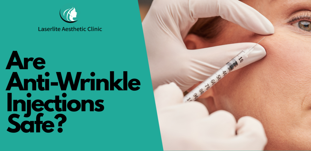 Are Anti Wrinkle-injections safe